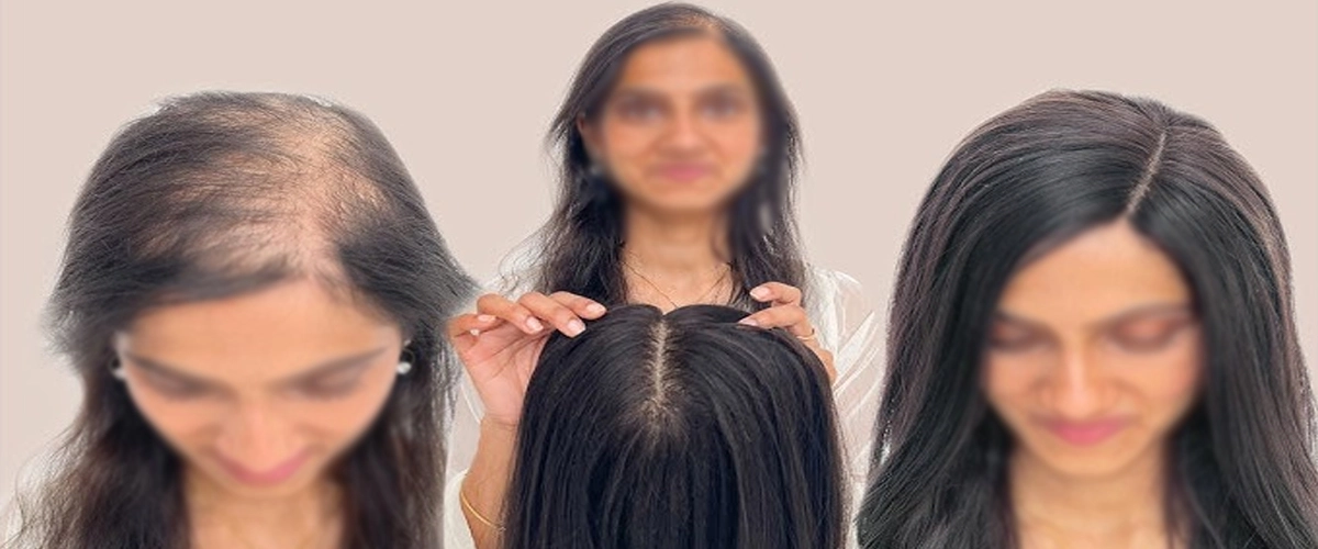 Affordable Hair Bonding for Women in Alambagh Lucknow