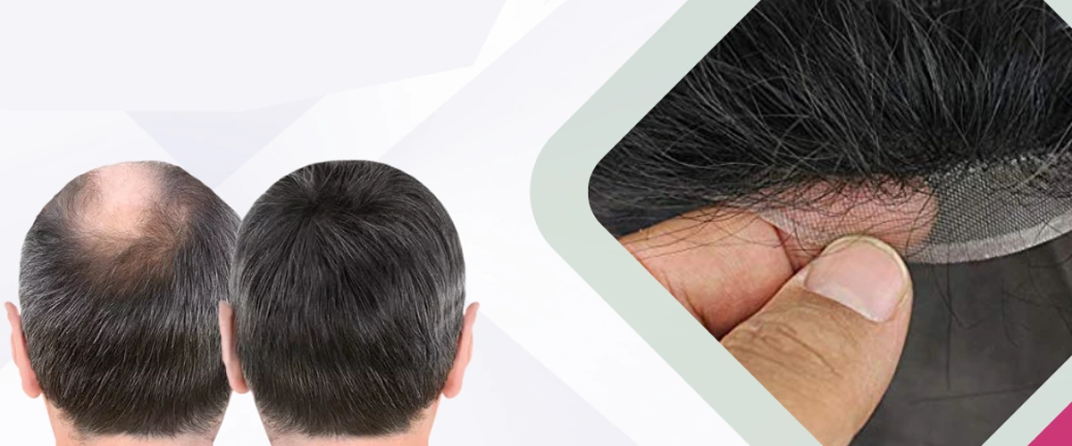 Non Surgical Hair Replacement Reviews – Real Stories from Ayub Hair Studio Clients