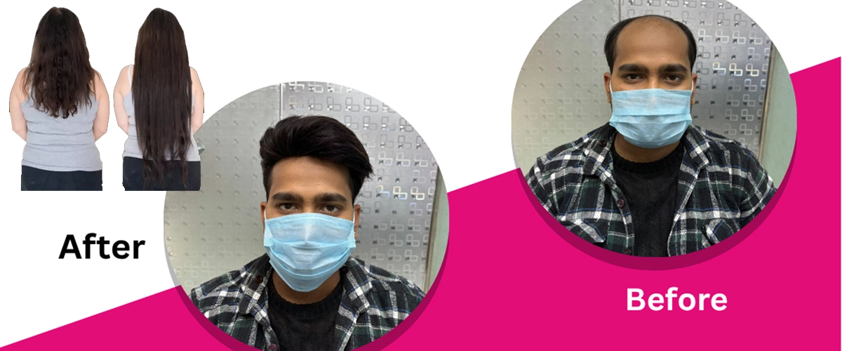 Affordable Hair Bonding for Women in Gorakhpur – Ayub Hair Studio